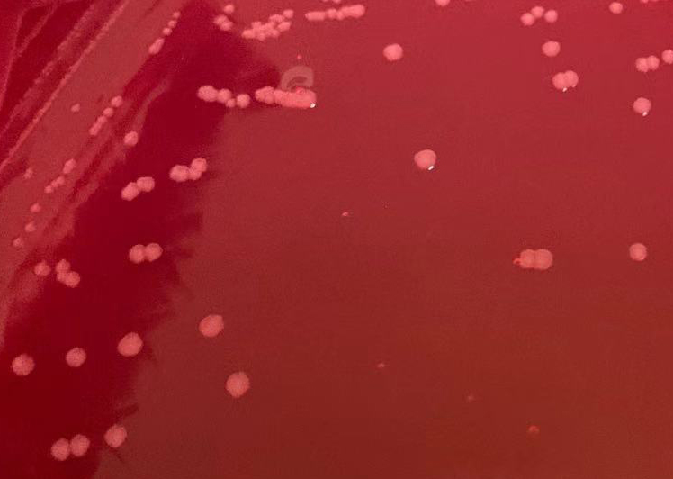 甲型副伤寒沙门菌CMCC50093  无色菌落，无黑心